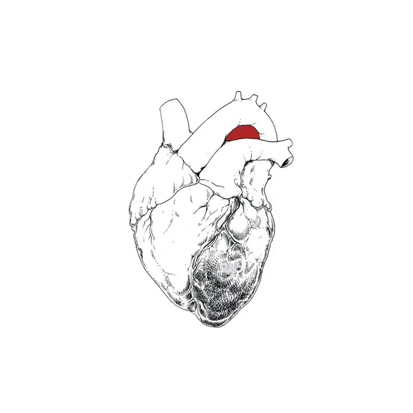 SWANS – the beggar (CD, LP Vinyl)