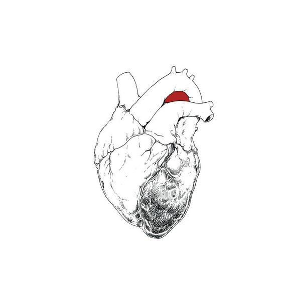 Cover SWANS, the beggar
